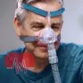 RespBuy-Lowenstein-cara-nasal-mask