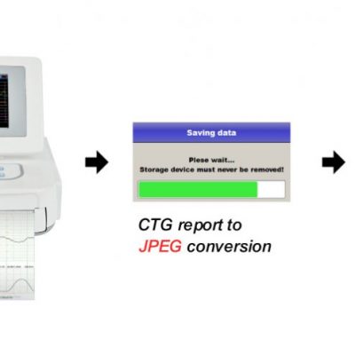 Respbuy-Bionet-FC1400-Fetal Monitor CTG to JPEG