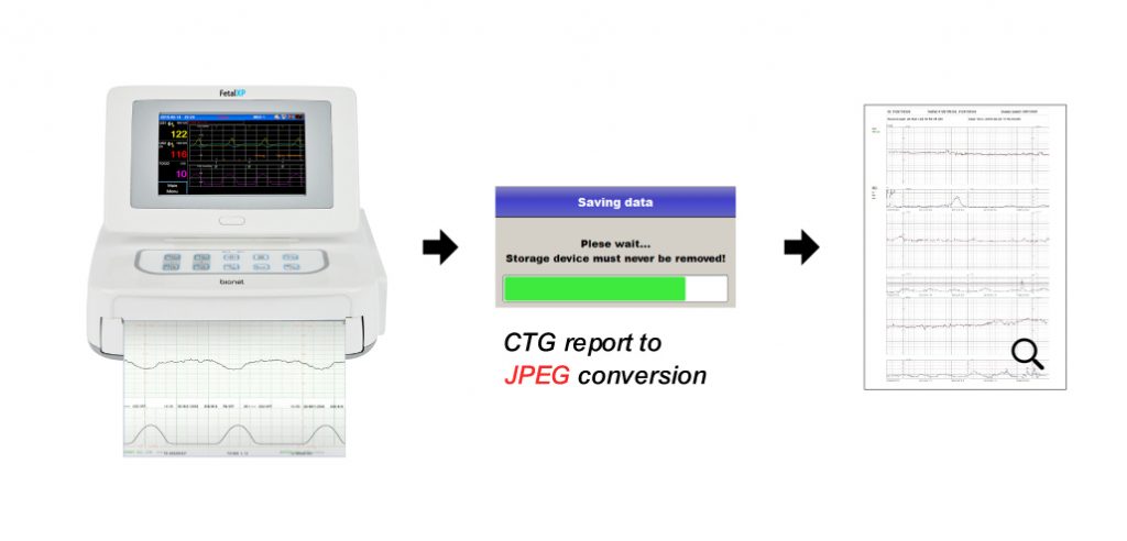 Respbuy-Bionet-FC1400-Fetal Monitor CTG to JPEG