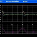 Respbuy-Bionet-FC1400-Fetal Monitor Graphic Modes