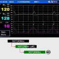 Respbuy-Bionet-FC1400-Fetal Monitor Trend Mode
