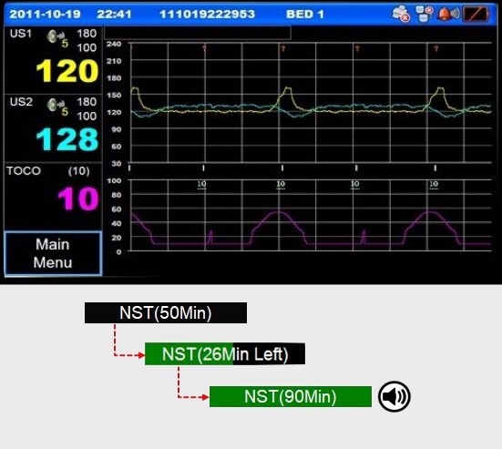 Respbuy-Bionet-FC1400-Fetal Monitor Trend Mode