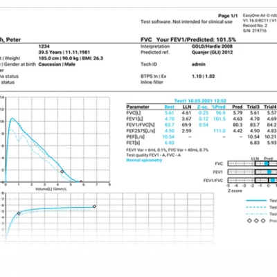 Respbuy_NDD_EasyOne Air_Spirometer Report