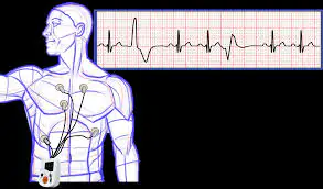Holter-Blog