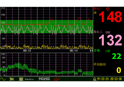 Respbuy_LuckCome_CTG3