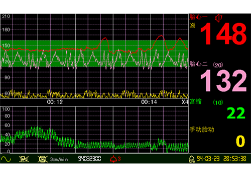 Respbuy_LuckCome_CTG3