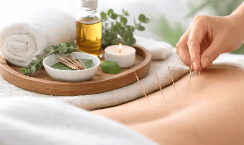 Acupuncture treatment with needles placed on a patient’s back for sleep and respiratory therapy.